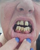 Dentzz Dental