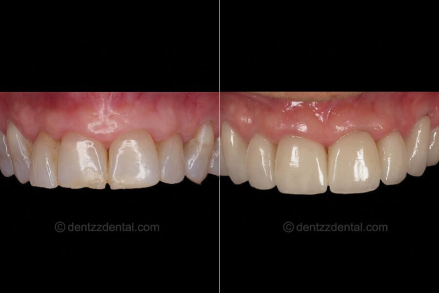 Dentzz Dental
